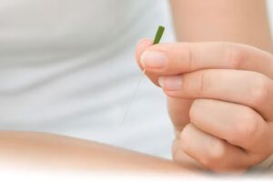 Akupunktur Landsberg, Dr. med. Iris Schneider